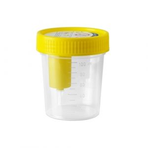 Qual' è il contenitore idoneo per la raccolta delle urine?